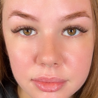 Bare Skin Essentials client beauty result