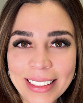 Bare Skin Essentials client beauty result